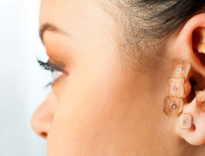 Riflessologia dell'orecchio: l'auricoloterapia 