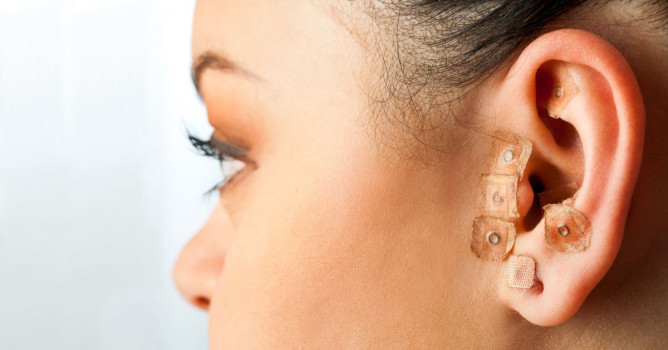 Riflessologia dell'orecchio: l'auricoloterapia 